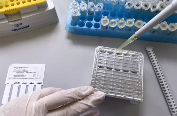 Ադրբեջանում կապիկի ծաղիկի առաջին դեպքն է գրանցվել